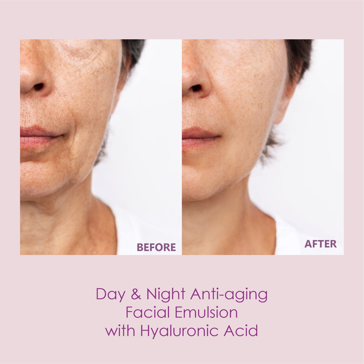 Straser - Hialuronika. Anti-Aging Facial Emulsion - 1.7 Fl. Oz.